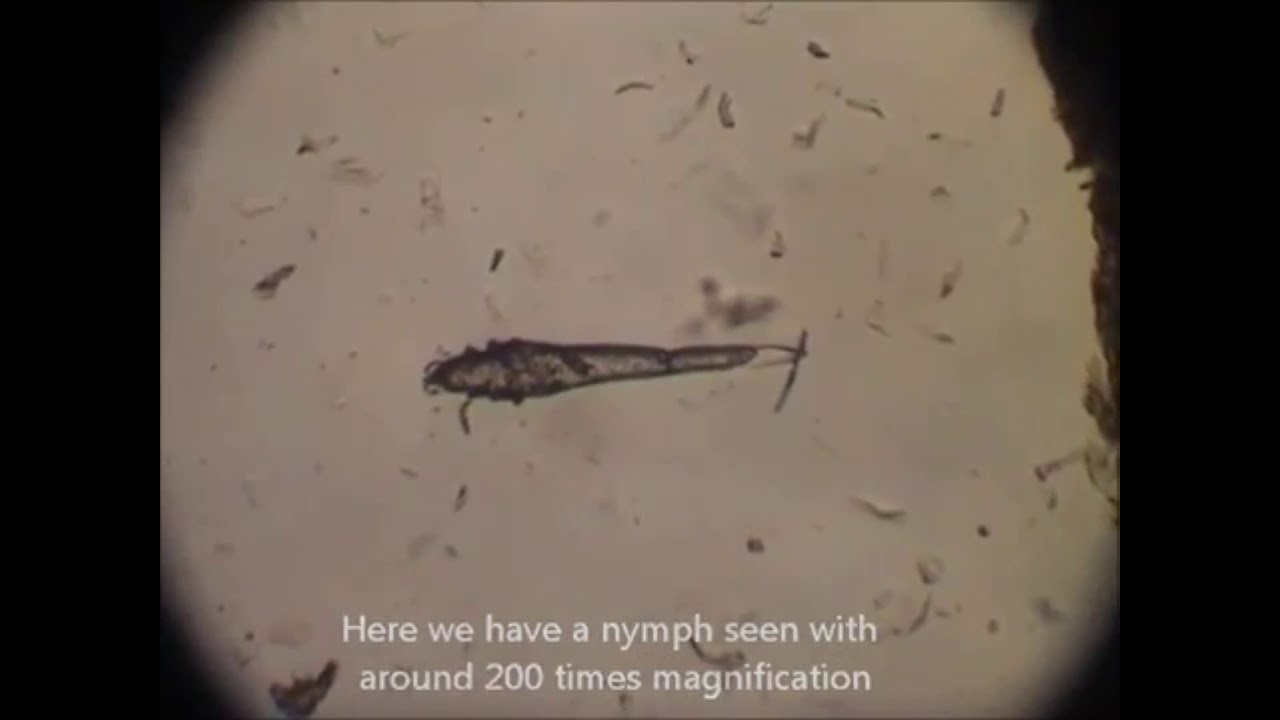 Как распознать клещей demodex  